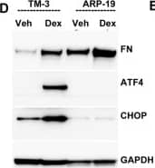 Western Blot: GADD153/CHOP Antibody - BSA Free [NBP2-13172] - TM cells are sensitive to ER stress from Dex-induced abnormal ECM compared to other ocular cells: Primary human TM cells (A), RPE (B) & corneal fibroblasts (C) were treated with Veh or Dex for 3 days & immunostained for fibronectin & KDEL. Although fibronectin was increased in all of these cell types, ER stress was only observed in TM cells. (D) Human GTM3 or ARPE-19 cells were treated with Veh or Dex for 3 days. Fibronectin & chronic ER stress markers ATF4 & CHOP were examined in cellular lysates (n = 2). Although Dex increased fibronectin in both GTM3 & ARPE-19 cells, chronic ER stress was only observed in GTM3 cells indicating that TM cells are more prone to ER stress from Dex-induced ECM accumulation. (E) GTM-3 or ARPE-19 cells were treated with cellular fibronectin (cFn) for 2 days & ER stress was examined by Western blot analysis. Image collected & cropped by CiteAb from the following publication (//www.nature.com/articles/s41598-017-14938-0), licensed under a CC-BY license. Not internally tested by Novus Biologicals.