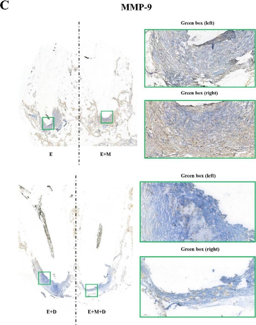 Immunohistochemistry MMP-9 Antibody (4A3) - BSA Free