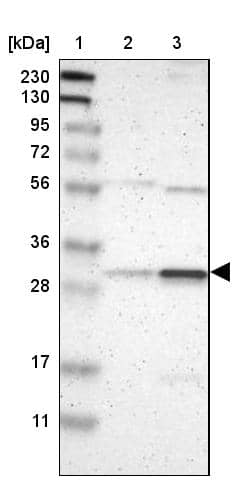 Lane 1: Marker [kDa] 230, 130, 95, 72, 56, 36, 28, 17, 11Lane 2: Human cell line RT-4Lane 3: Human cell line U-251MG sp