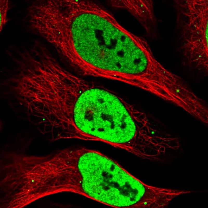 Staining of human cell line U-2 OS shows localization to nucleoplasm & vesicles.