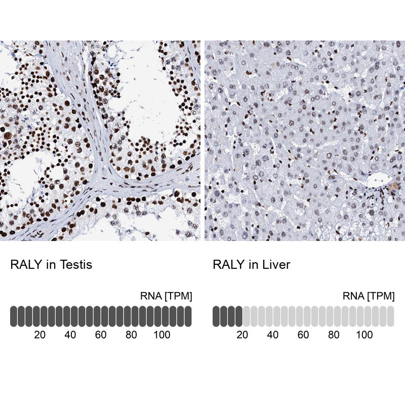 <b>Orthogonal Strategies Validation. </b>Analysis in human testis and liver tissues using Anti-RALY antibody. Corresponding RALY RNA-seq data are presented for the same tissues.