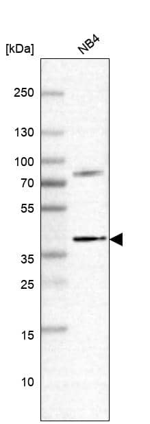 Analysis in human cell line NB4.