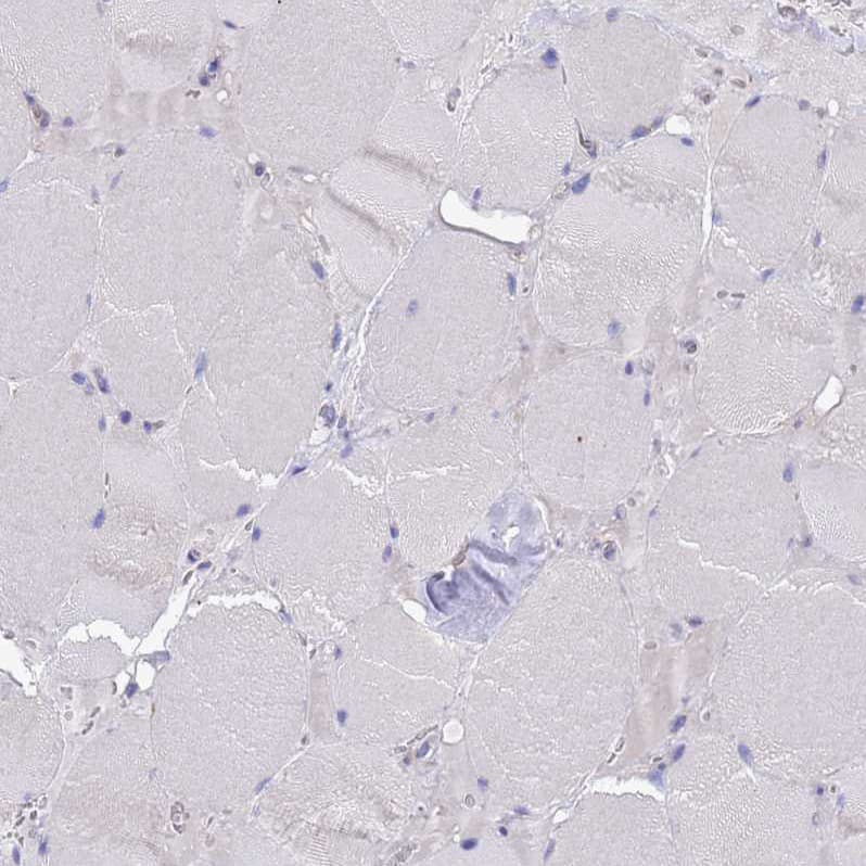 Immunohistochemistry MNAB Antibody - BSA Free
