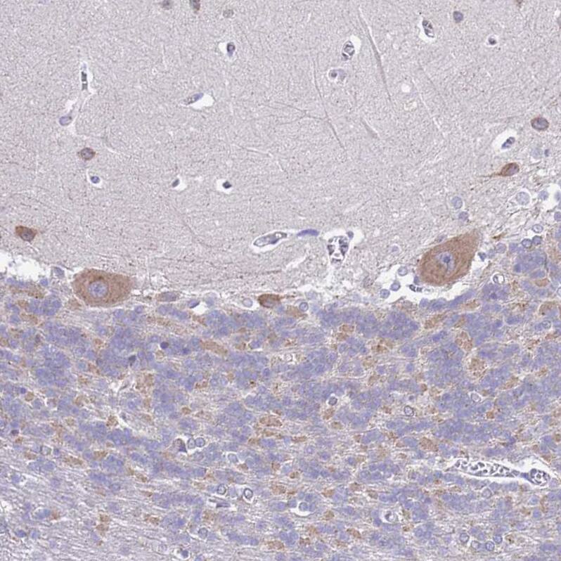 Immunohistochemistry MNAB Antibody - BSA Free
