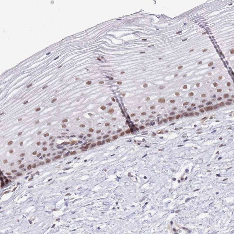 Immunohistochemistry RFX1 Antibody - BSA Free