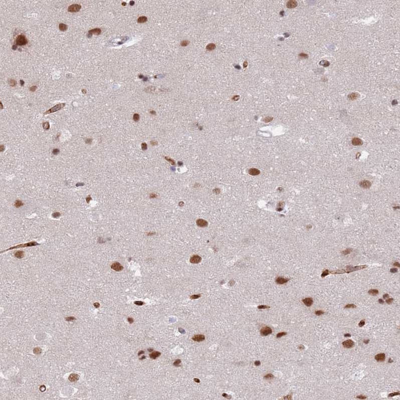 Immunohistochemistry RFX1 Antibody - BSA Free