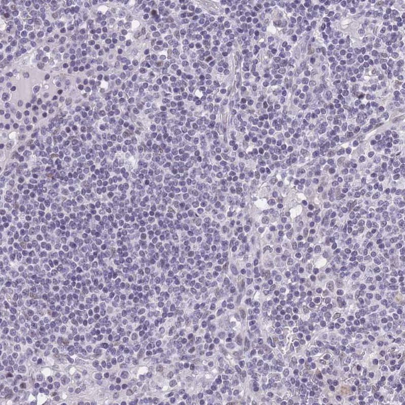 Immunohistochemistry RFX1 Antibody - BSA Free