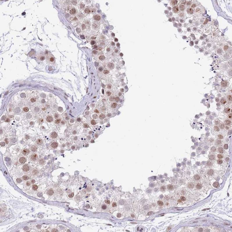 Immunohistochemistry RFX1 Antibody - BSA Free
