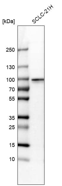 Analysis in human cell line SCLC-21H.