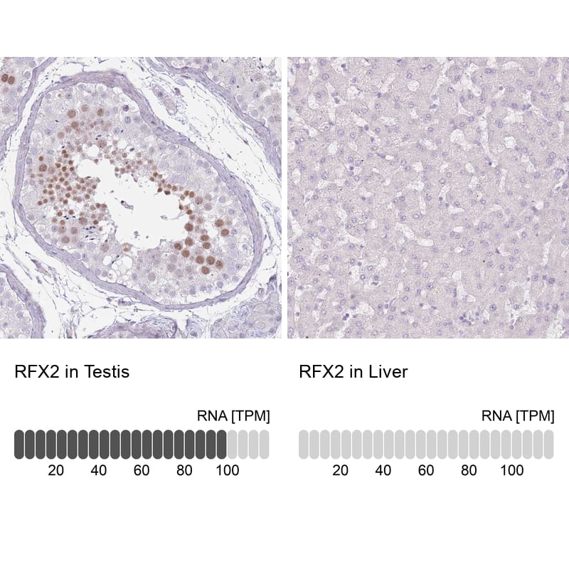 Analysis in human testis and liver tissues using NBP2-13224 antibody. Corresponding RFX2 RNA-seq data are presented for the same tissues.