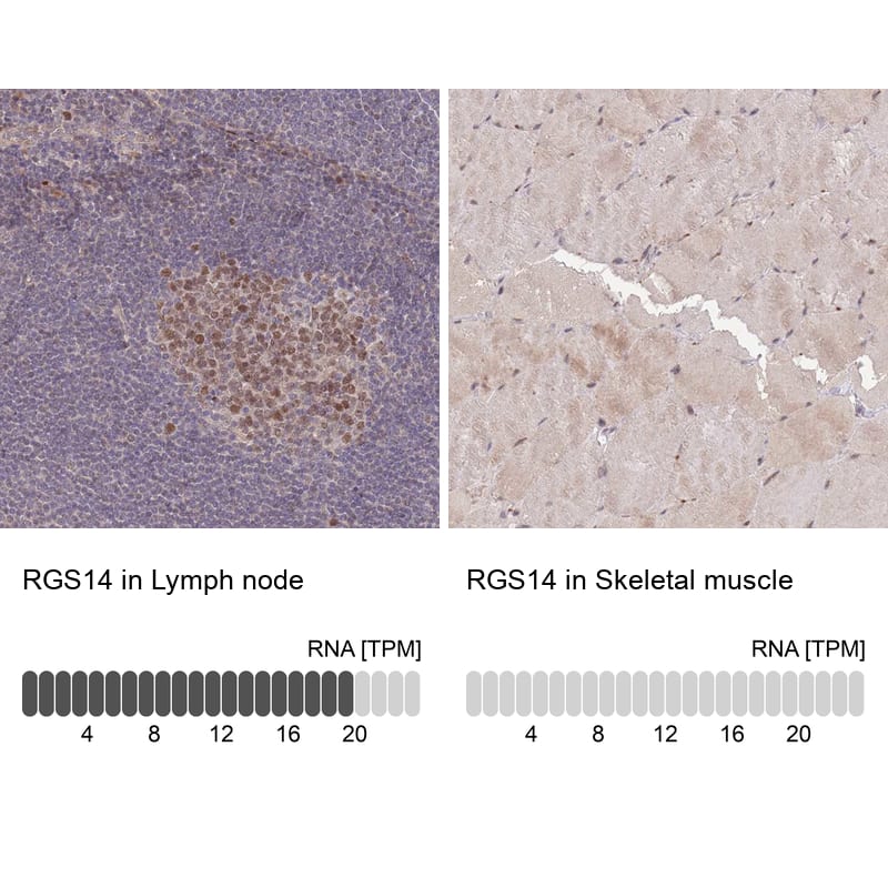 <b>Orthogonal Strategies Validation. </b>Analysis in human lymph node and skeletal muscle tissues using Anti-RGS14 antibody. Corresponding RGS14 RNA-seq data are presented for the same tissues.