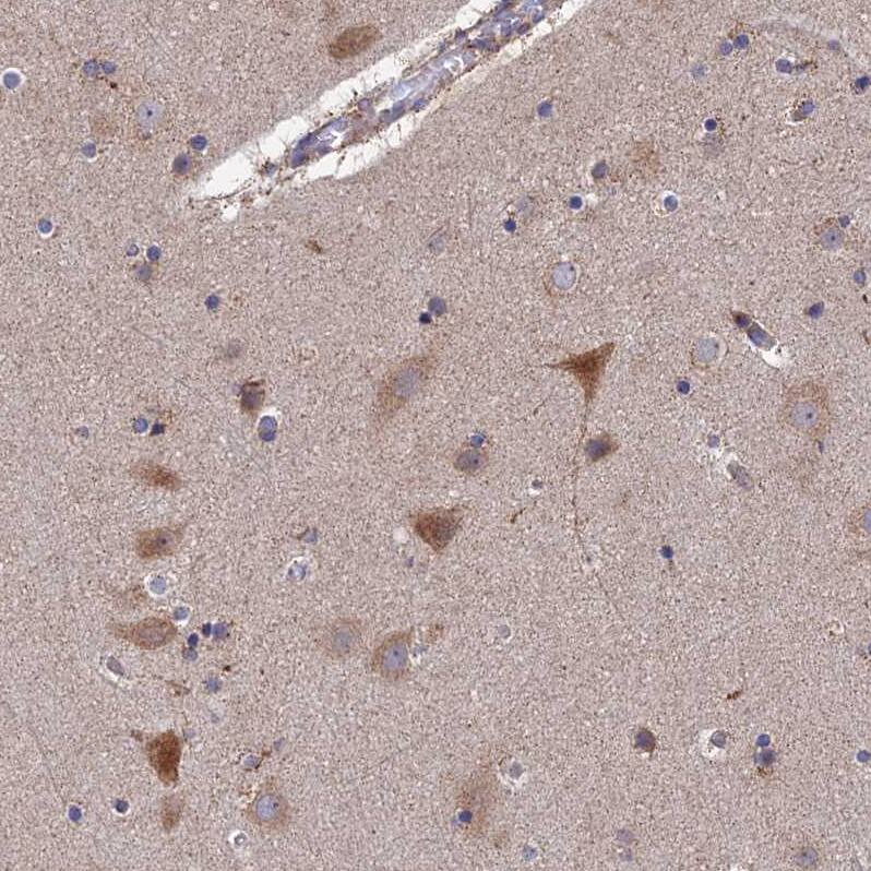 Staining of human cerebral cortex shows weak to moderate cytoplasmic positivity in neurons.