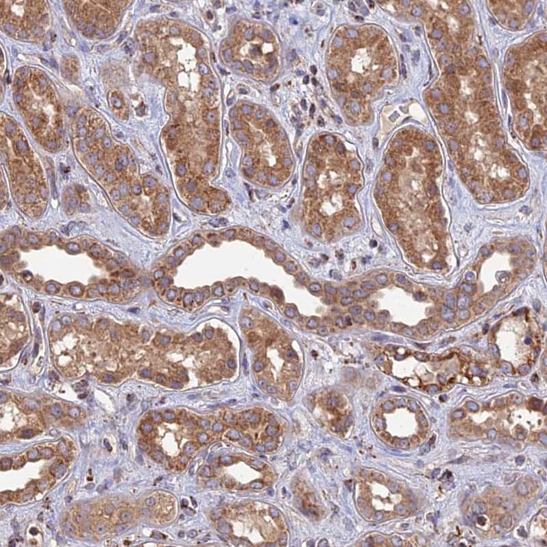 Staining of human kidney shows moderate to strong cytoplasmic positivity in granular layer.