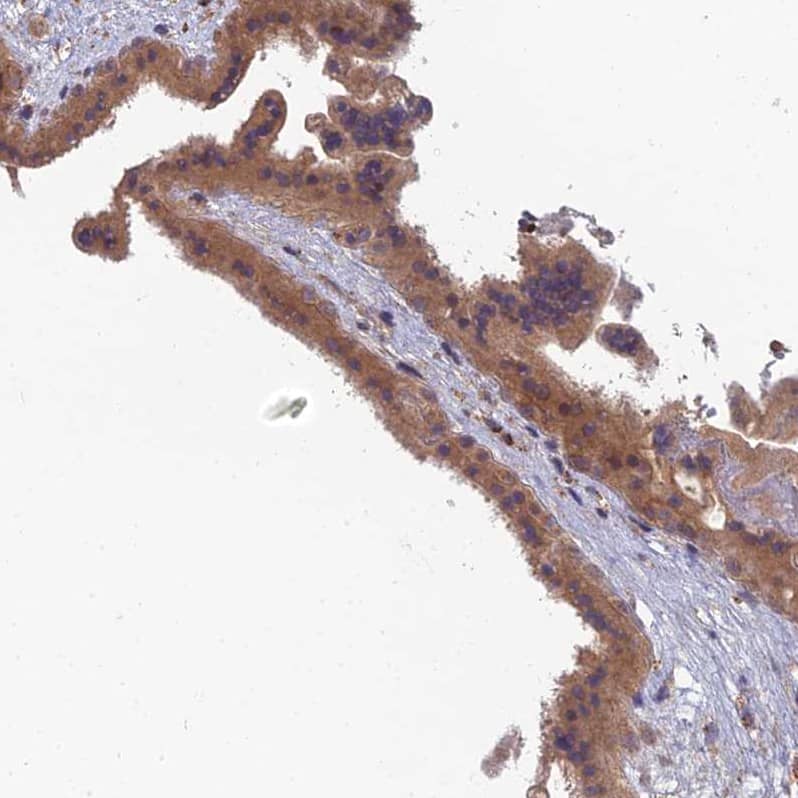 Staining of human fallopian tube shows moderate to strong cytoplasmic positivity in granular layer.