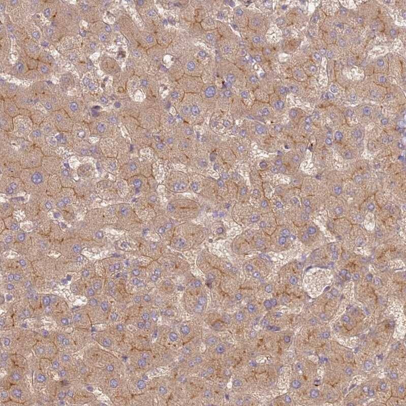 Staining of human liver shows strong cytoplasmic positivity in hepatocytes.