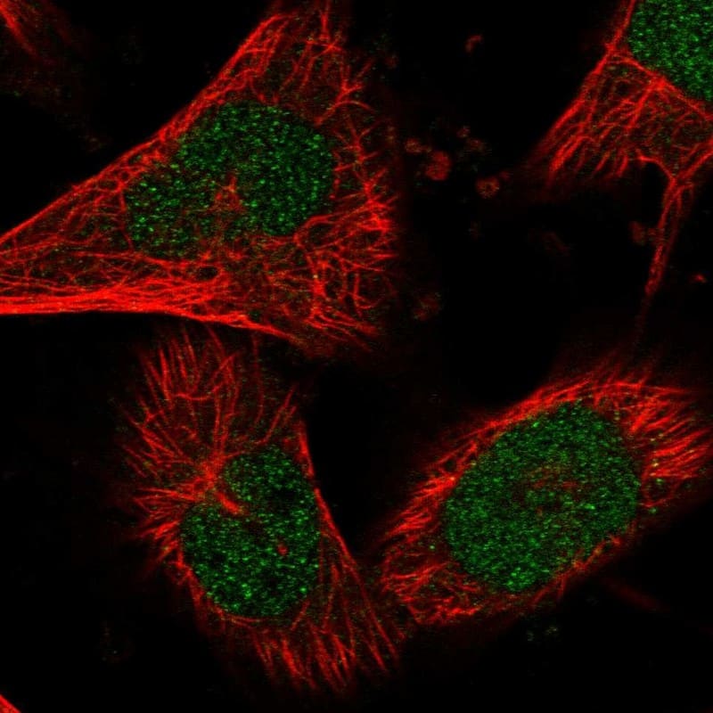 Staining of human cell line U-251 MG shows localization to nucleoplasm.