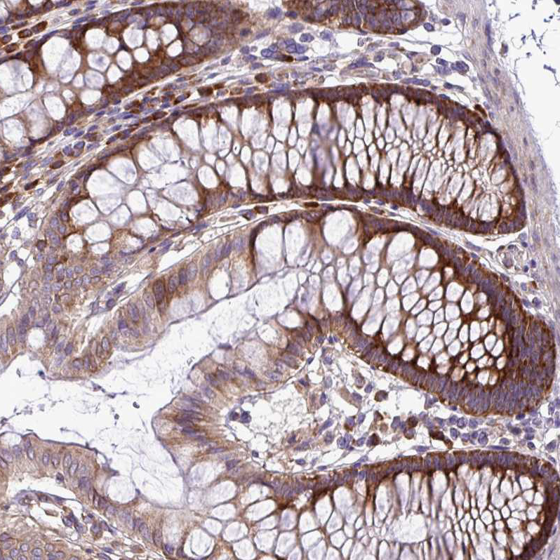Staining of human colon shows moderate cytoplasmic positivity in glandular cells.