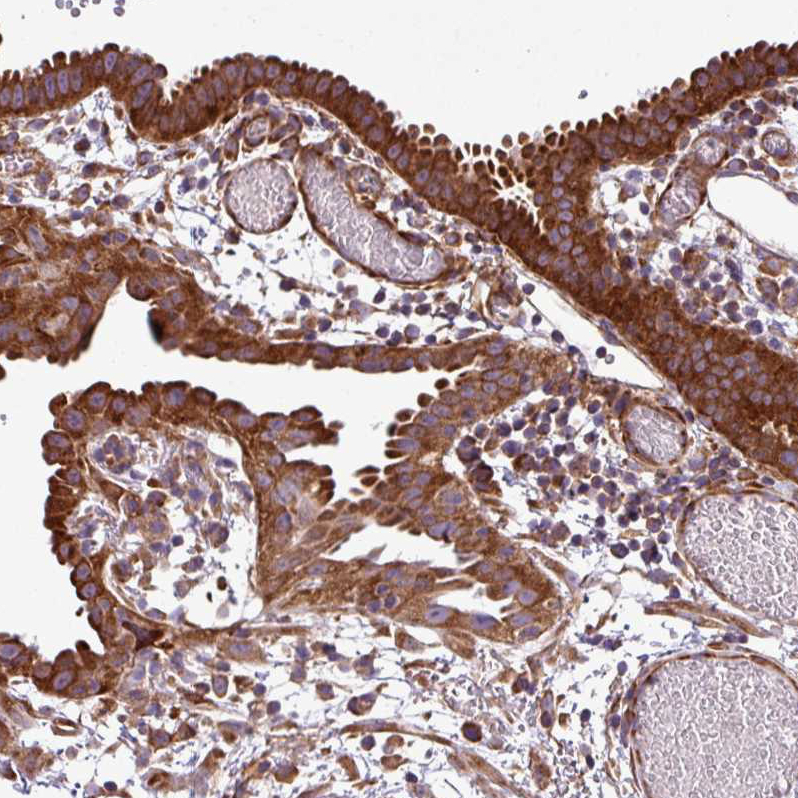 Staining of human fallopian tube shows strong cytoplasmic positivity in glandular cells.