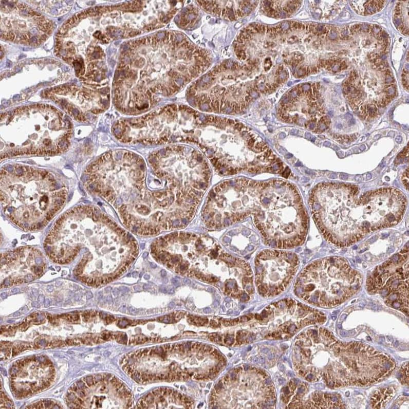 Staining of human kidney shows strong cytoplasmic positivity in cells in tubules.