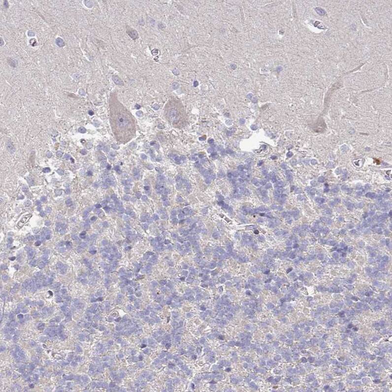 Staining of human cerebellum shows no positivity in Purkinje cells as expected.
