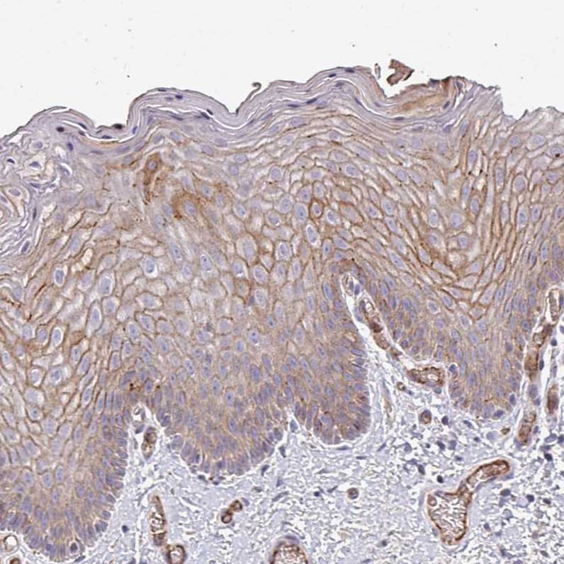 Staining of skin shows weak membranous positivity in squamous epithelial cells.