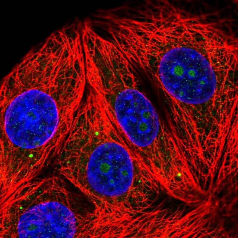 Staining of human cell line MCF7 shows positivity in nucleoli & vesicles.