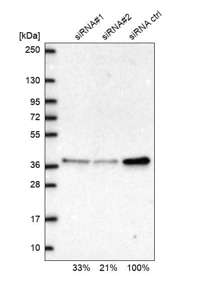 Analysis in U2OS cells transfected with control siRNA, target specific siRNA probe #1 and #2. Remaining relative intensity is presented