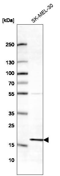 Analysis in human cell line SK-MEL-30.