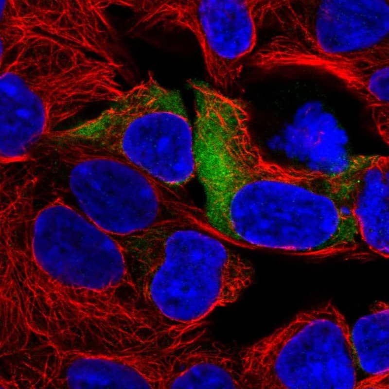 Staining of human cell line HEK 293 shows localization to cytosol & endoplasmic reticulum.