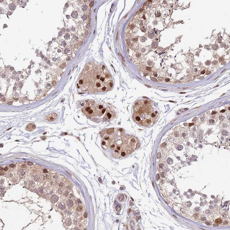 Staining of human testis shows moderate nuclear positivity in Leydig cells and cells in seminiferous ducts.