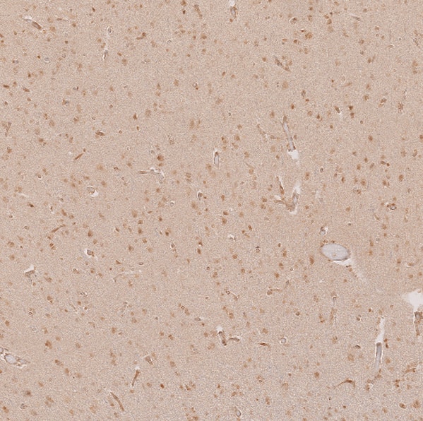 Staining of human cerebral cortex shows moderate nuclear and cytoplasmic positivity in neuronal cells.