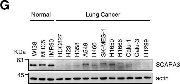 SCARA3 is aberrantly downregulated in lung cancer. A Expression of SCARA3 mRNA in 10 primary cancer types from TCGA. Data are shown as mean +/- SD. ns, not significant; ***, P < 0.001, two-tailed Student’s t-test. B SCARA3 gene is located on the short arm of chromosome 8 at position 8q21.1. C Alteration frequency of SCARA3 gene in 10 cancer types from TCGA. D Kaplan-Meier analysis of survival according to SCARA3 in lung cancer, breast cancer, and head and neck cancer patients. P values are from a Log-rank test. E, F SCARA3 protein was immunohistochemically stained with brown color in the cytoplasm and/or nuclei of lung cancer tissues. Scale bar = 100 μm. G, H Expression levels of SCAR3 proteins (G) mRNAs (H) were determined by Western blot and RT- qPCR, respectively, using specific anti-SCARA3 antibodies and SCARA3-specific primers in various lung cancer cell lines and adjacent normal cell lines. Data are presented as mean +/- SD of three independent experiments. **, P < 0.01; ***, P < 0.001 Image collected and cropped by CiteAb from the following open publication (//pubmed.ncbi.nlm.nih.gov/35578316), licensed under a CC-BY license. Not internally tested by Novus Biologicals.
