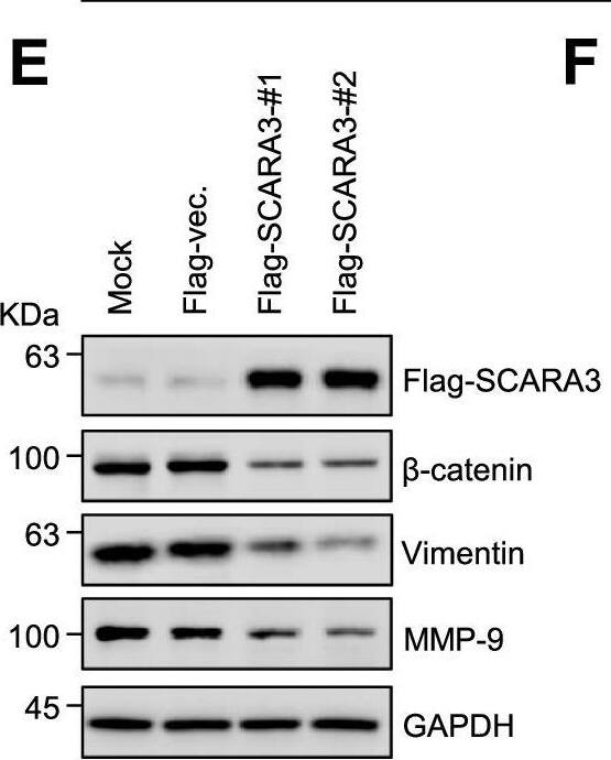 Overexpression of SCARA3 downregulates Epithelial-Mesenchymal Transition (EMT). A Migration of H1299 and A549 cells determined with Transwell assays. B H1299 and A549 invasion ability examined by Matrigel Transwell invasion assay. Quantitative results of migration and invasion assays are shown below. Data are presented as mean +/- SD of three independent experiments. ***, P < 0.001. C Flag-tagged SCARA3 was expressed in H1299 cells. Protein levels of  beta -catenin, vimentin, and MMP9 were examined by Western blot using their specific antibodies. D Immunofluorescent staining of fixed H1299 cells with anti-Flag and  beta -catenin antibodies. Nuclei were stained with DAPI. Scale bar = 20 μm. E Flag-tagged SCARA3 was expressed in A549 cells. Protein levels of  beta -catenin, vimentin, and MMP9 were examined by Western blot using their specific antibodies. F Immunofluorescent staining of fixed A549 cells with anti-Flag and  beta -catenin antibodies. Nuclei were stained with DAPI. Scale bar = 20 μm Image collected and cropped by CiteAb from the following open publication (//pubmed.ncbi.nlm.nih.gov/35578316), licensed under a CC-BY license. Not internally tested by Novus Biologicals.