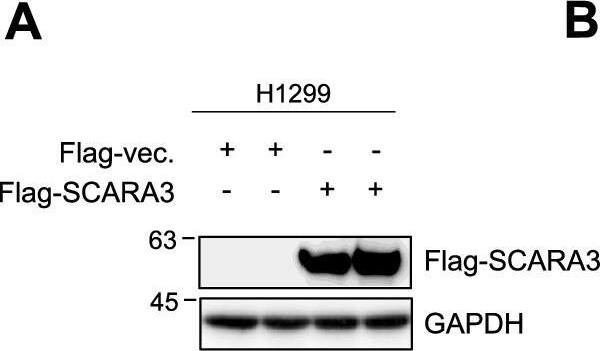 SCARA3 inhibits proliferation of lung cancer in vivo. A Western blot analysis for Flag-SCARA3 expression in indicated H1299 cells. B Tumors derived from indicated H1299 cells at end point (n = 5 mice per group). C Average tumor weight of indicated group at the endpoint of the experimenth. D Growth curves of tumors derived from indicated H1299 cells in mice. Data are shown as mean +/- SD. ***, P < 0.001, two-way ANOVA. E Western blot analysis for shSCARA3 expression in indicated A549 cells. F Tumors derived from the indicated A549 cells at end point (n = 5 mice per group). G Average tumor weight of the indicated group at the endpoint of the experiment. H Growth curves of tumors derived from indicated A549 cells in mice. Data are shown as mean +/- SD. ***, P < 0.001, two-way ANOVA. I and J Tumor sections from mice injected with indicated H1299 and A549 cells were stained with hematoxylin-eosin. Immunostained sections were stained with SCARA3 and Ki67. Scale bar = 100 μm Image collected and cropped by CiteAb from the following open publication (//pubmed.ncbi.nlm.nih.gov/35578316), licensed under a CC-BY license. Not internally tested by Novus Biologicals.