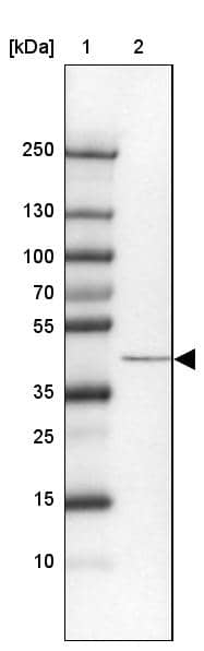 Lane 1: Marker [kDa] 250, 130, 100, 70, 55, 35, 25, 15, 10Lane 2: Human cell line RT-4