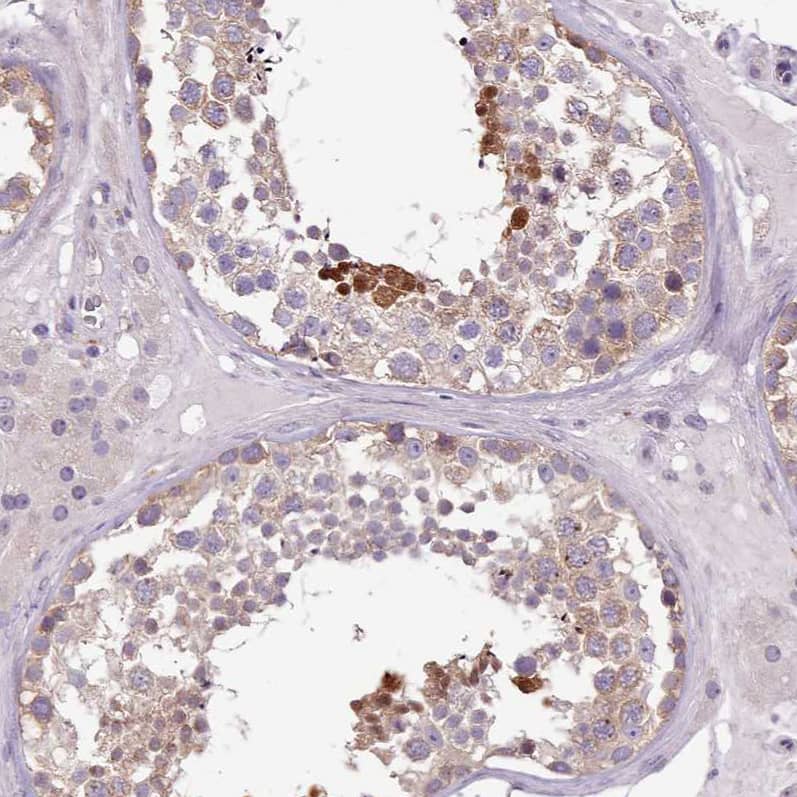 Staining of human testis shows strong nuclear positivity in a subset of cells in seminiferous ducts.