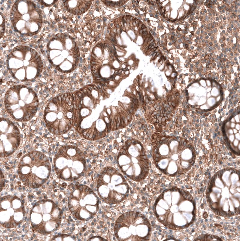 Staining of human rectum shows moderate membranous and cytoplasmic positivity in glandular cells.