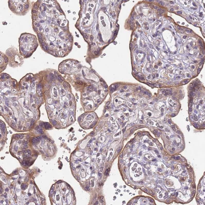 Staining of human placenta shows moderate membranous positivity in trophoblastic cells.