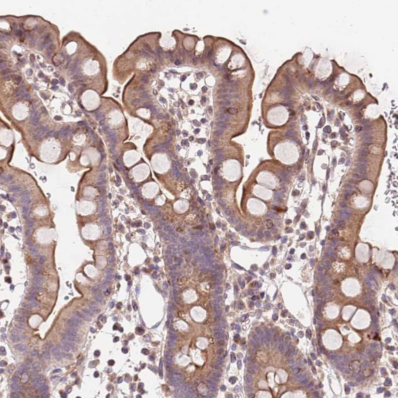 Staining of human small intestine shows moderate membranous and cytoplasmic positivity in glandular cells.