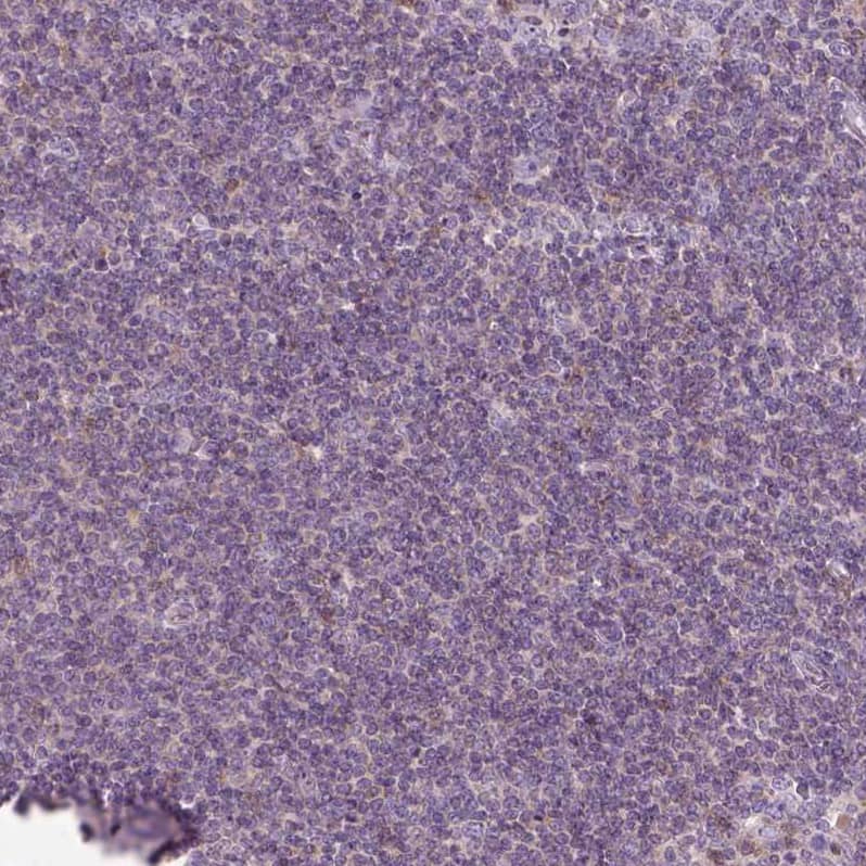 Staining of human tonsil shows no positivity in non-germinal center cells as expected.