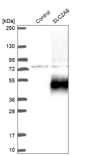 Western Blot Glucose Transporter GLUT6 Antibody - BSA Free