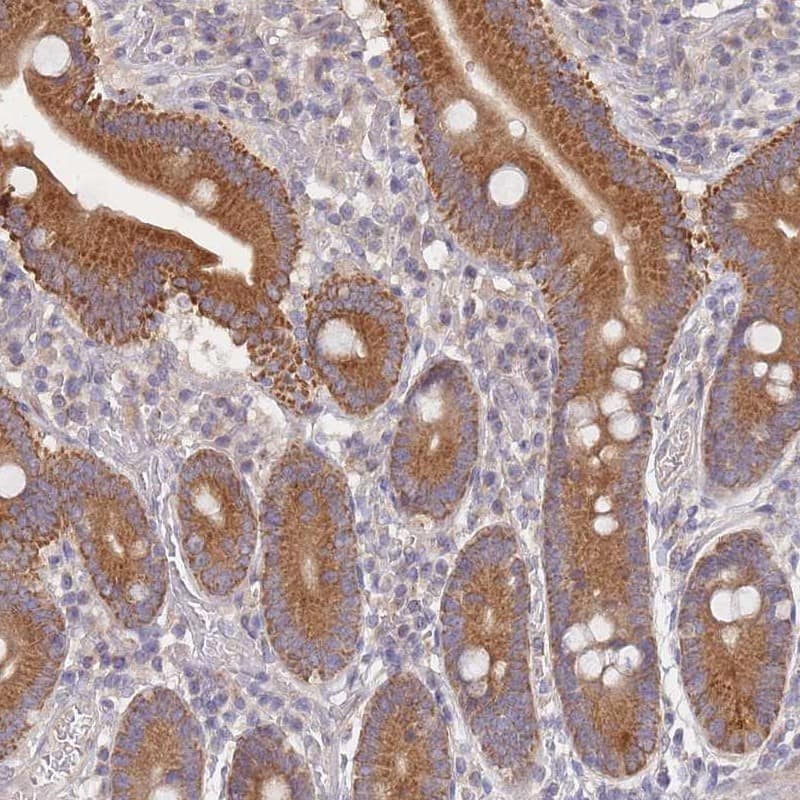 Immunohistochemistry-Paraffin SLC35F5 Antibody - BSA Free
