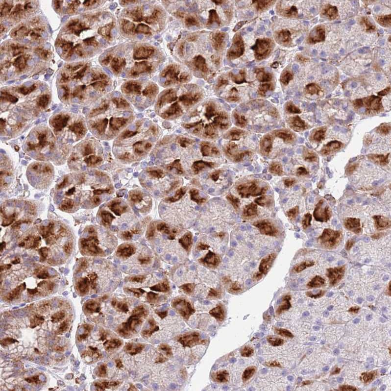 Immunohistochemistry Snx6 Antibody - BSA Free