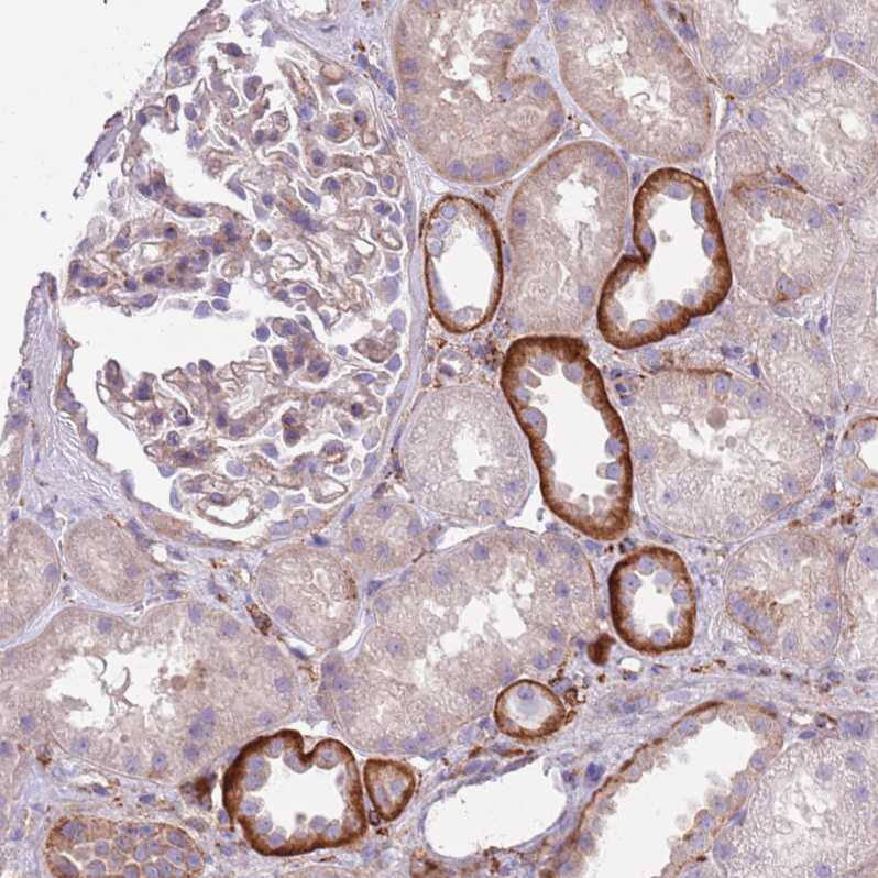 Staining of human kidney shows strong membranous positivity in cells in tubules.