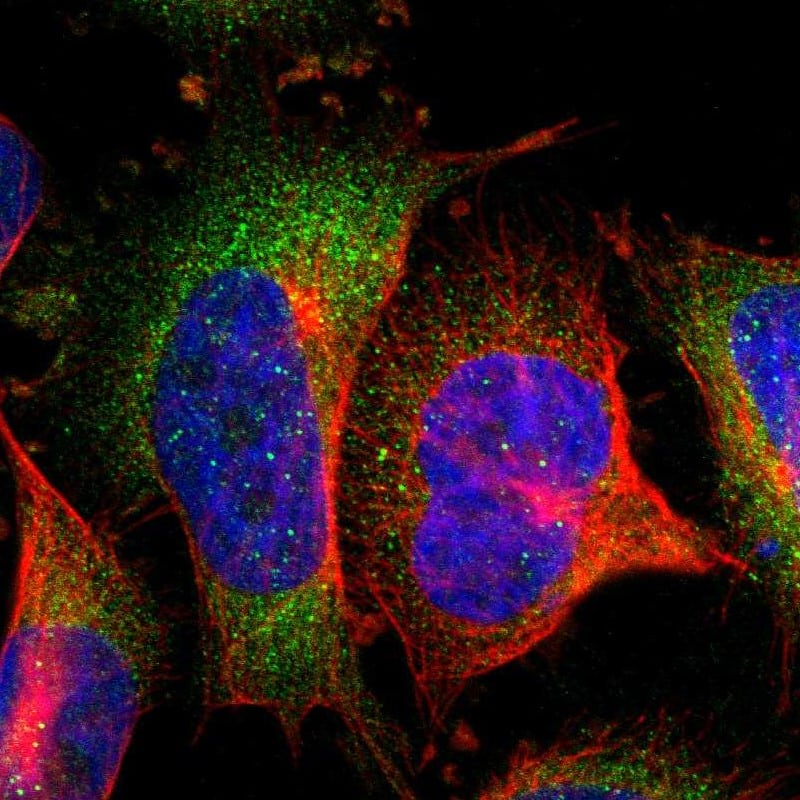 Staining of human cell line U-251 MG shows localization to cytosol.