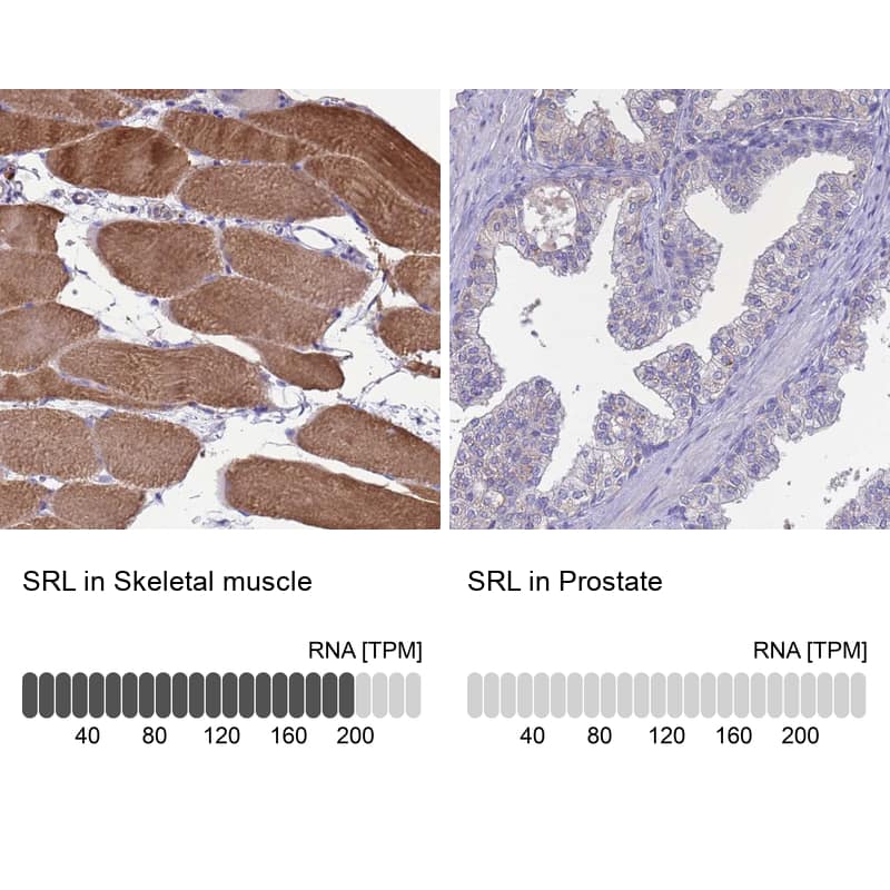 <b>Orthogonal Strategies Validation. </b>Analysis in human skeletal muscle and prostate tissues using Anti-SRL antibody. Corresponding SRL RNA-seq data are presented for the same tissues.