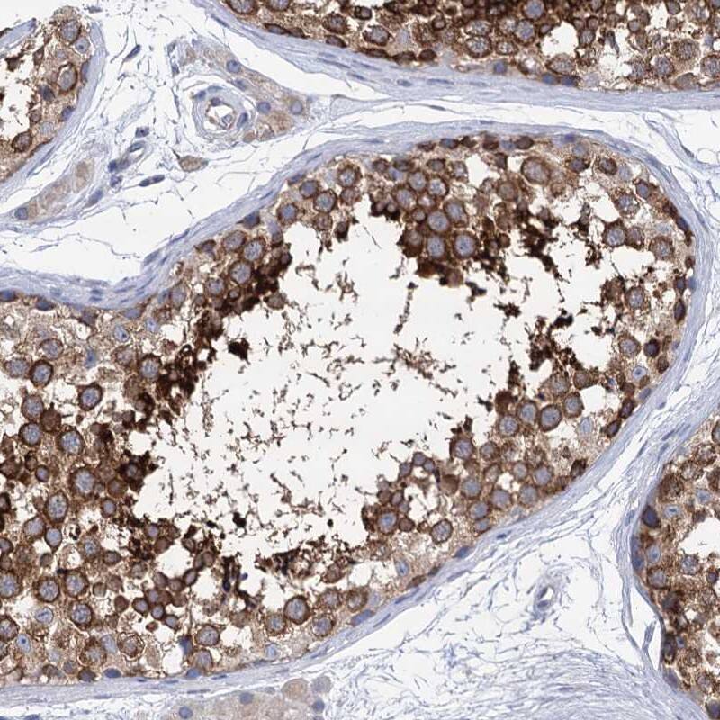 Staining of human testis shows strong cytoplasmic positivity in cells in seminiferus ducts.