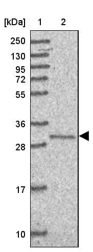 Lane 1: Marker [kDa] 250, 130, 95, 72, 55, 36, 28, 17, 10Lane 2: Human cell line RT-4