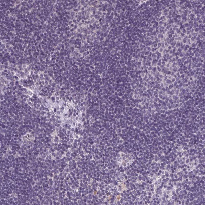 Immunohistochemistry Collectrin/TMEM27 Antibody - BSA Free