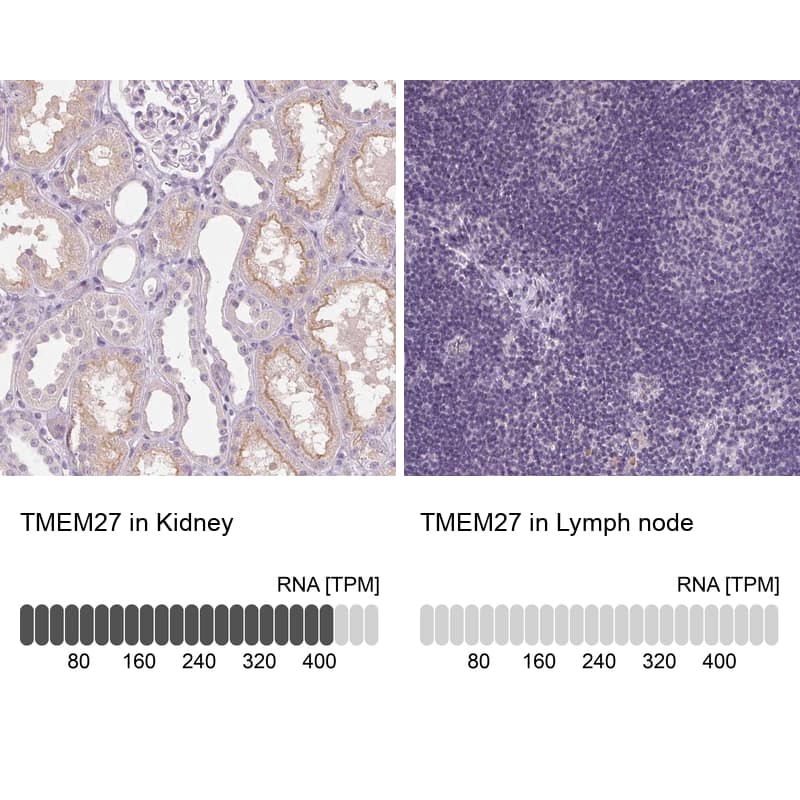 Immunohistochemistry Collectrin/TMEM27 Antibody - BSA Free